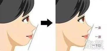 医生称森碟下巴后缩或影响口腔功能