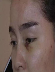 光头强做了微整形