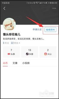今日头条怎么起名字