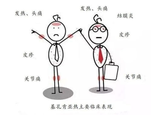 基孔肯雅热先兆症状