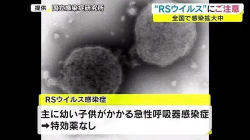 日本百日咳持续蔓延
